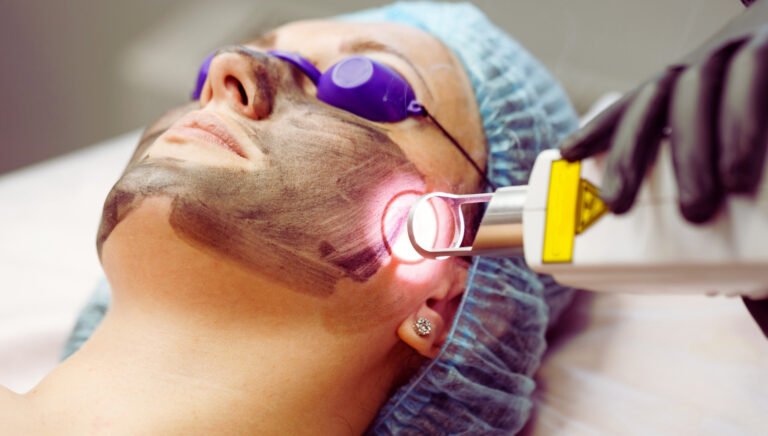 How Laser Therapy Helps Reduce Skin Pigmentation and Dark Spots Safely