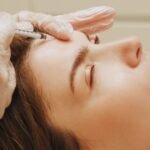 Acne Treatment in Aligarh: Clear Skin Solutions That Work