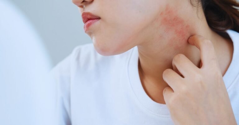 Advanced Itchy Skin Treatment in Aligarh for Skin Health