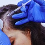 Hair Fall Treatment in Aligarh for Stronger Hair Growth