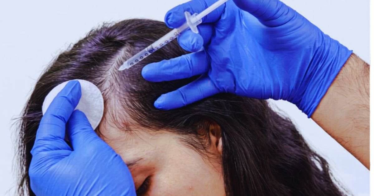 Hair Fall Treatment in Aligarh for Stronger Hair Growth