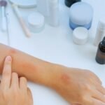 Itchy Skin Treatment in Aligarh: Causes and Care
