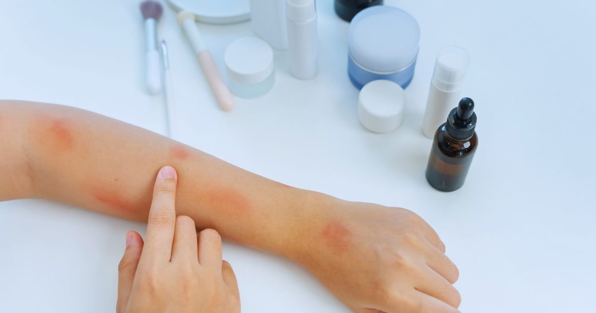Itchy Skin Treatment in Aligarh: Causes and Care