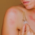 Skin Allergy Treatment in Aligarh: Causes and Solutions