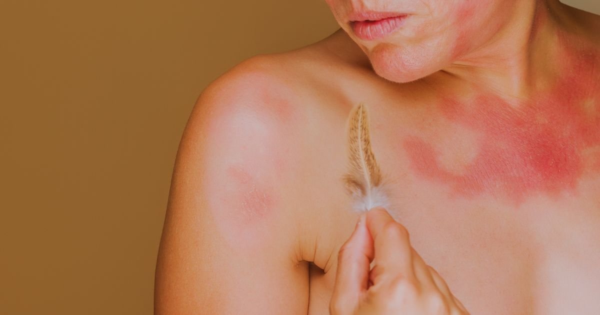 Skin Allergy Treatment in Aligarh: Causes and Solutions