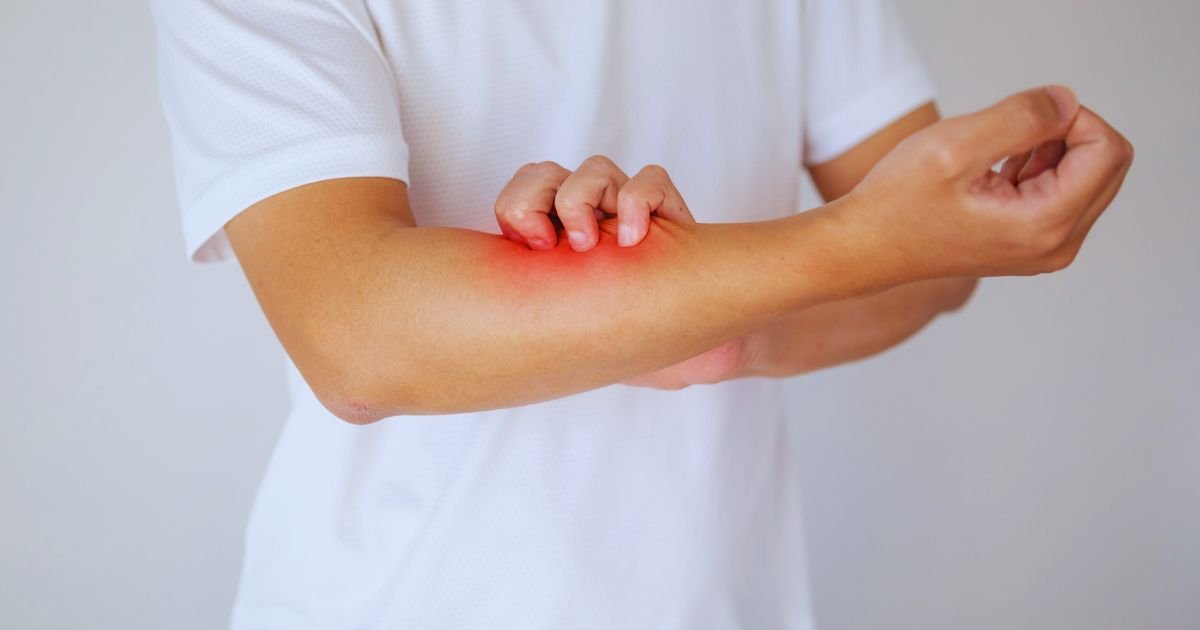 Where to Get Itchy Skin Treatment in Aligarh Safely