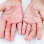 Varun Skin Solutions - Visit an Aligarh Dermatologist for Expert Skin Advice