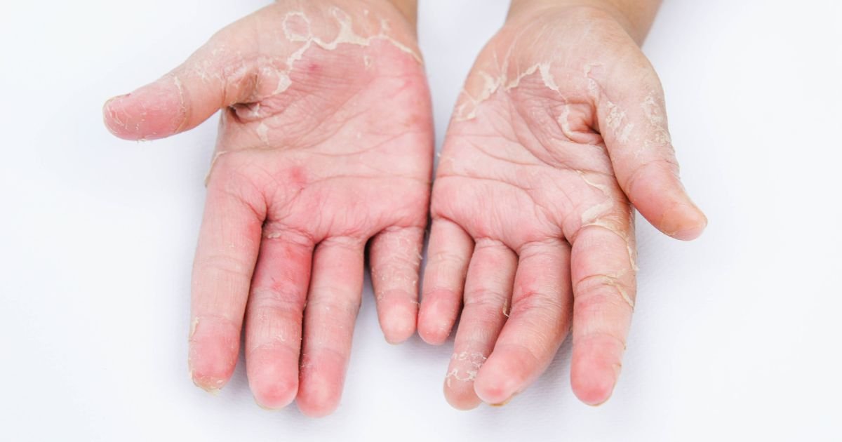Varun Skin Solutions - Visit an Aligarh Dermatologist for Expert Skin Advice