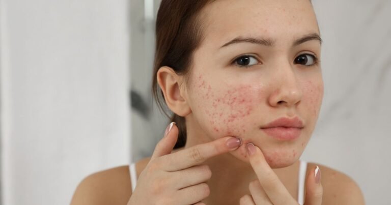 Varun Skin Solutions - Allergy Rashes Treatment in Aligarh for Healthy Skin
