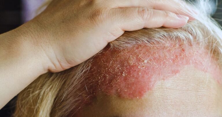 Varun Skin Solutions - Hair Treatment in Aligarh for Hair Fall and Scalp Care
