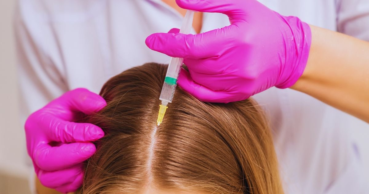 Varun Skin Solutions - Where to Get Hair Fall Treatment in Aligarh Safely