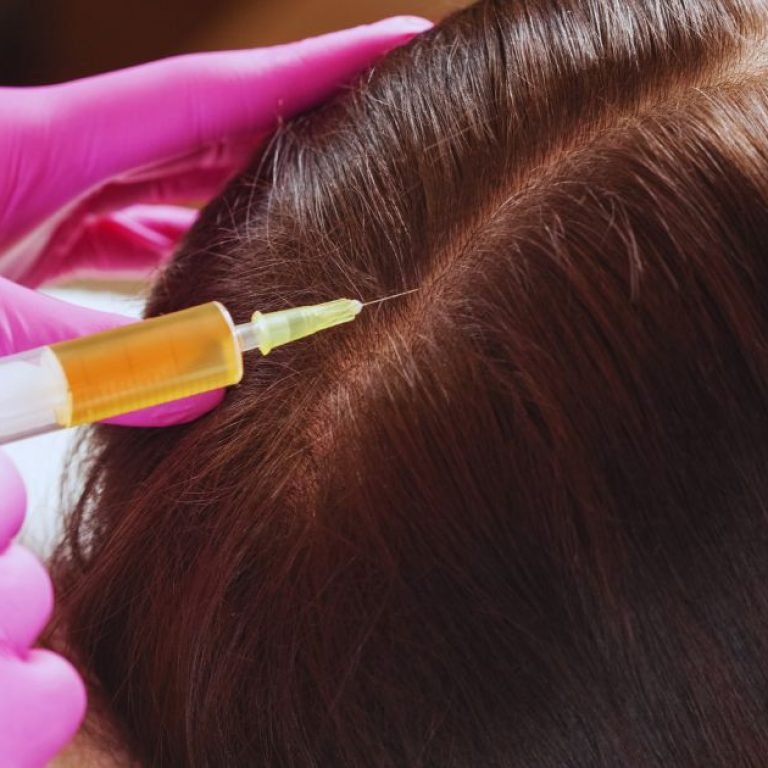 How PRP Therapy Helps Restore Hair Growth and Skin Health