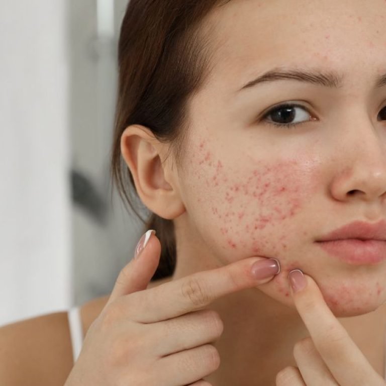 Varun Skin Solutions - Allergy Rashes Treatment in Aligarh for Healthy Skin